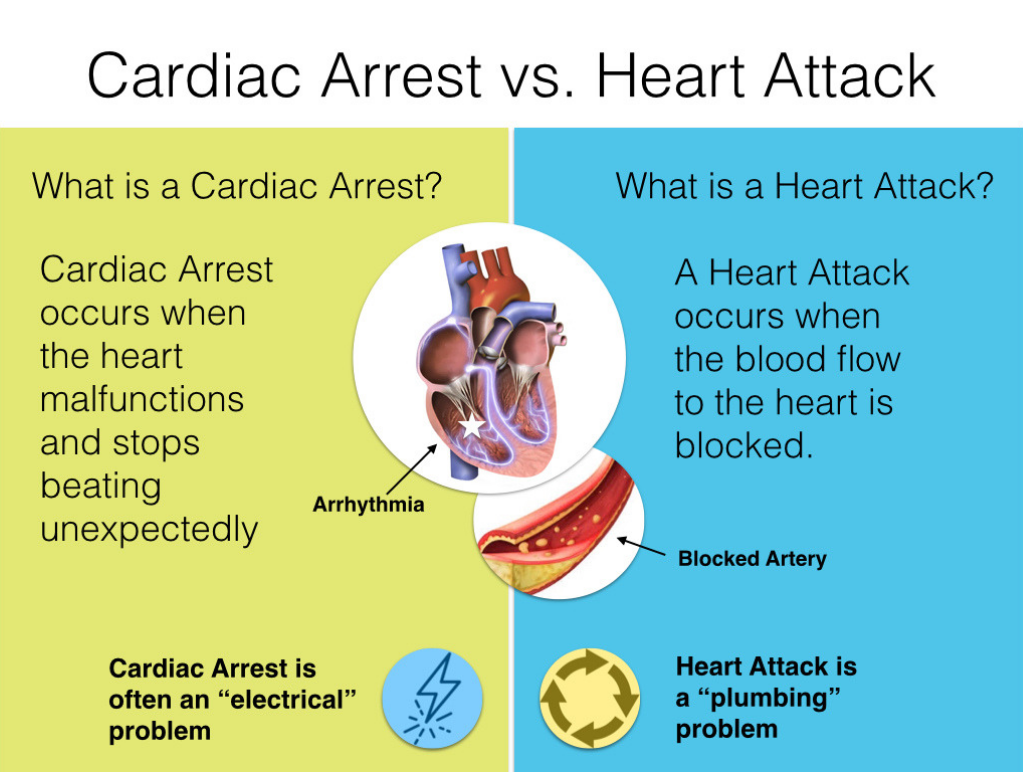 What Is Cardiac Arrest And How Does It Happen - Printable Templates Protal